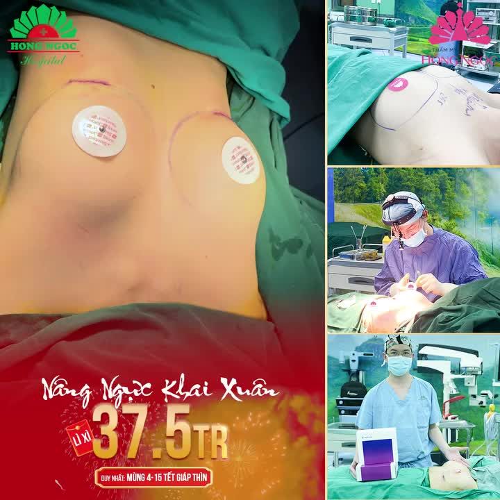 NÂNG VÒNG 1 ĐÓN LỘC ĐẦU XUÂN Lì xì lên tới 37.5TR