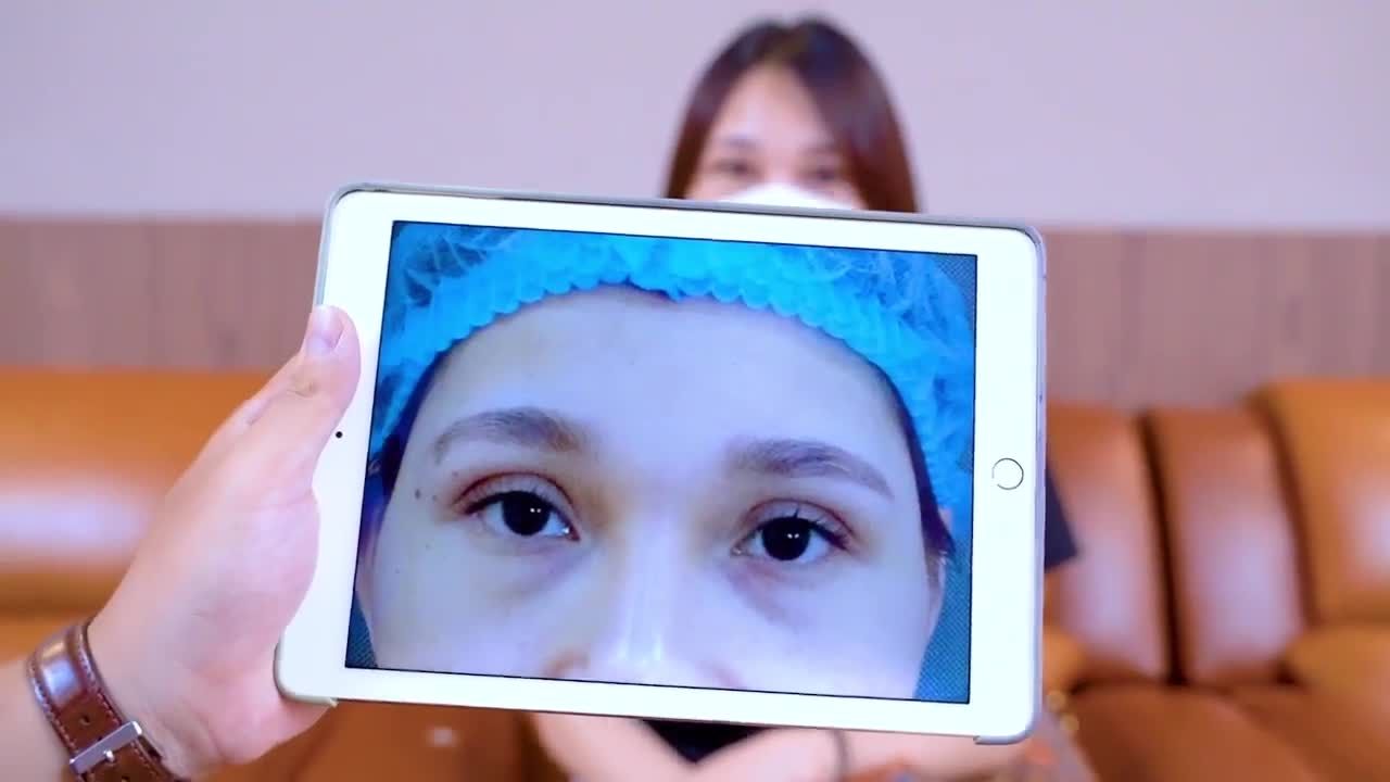 7 ngày sau sửa mí Deep Tech tại Dr.Hải Lê, chị gái đã sở hữu cho mình đôi mắt tự tin như thế nào?