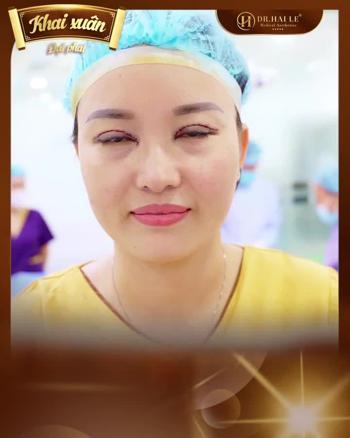 Đôi mắt rạng rỡ, ánh nhìn thu hút sẽ là tạo ra ấn tượng đặc biệt với người đối diện, vậy bạn đã sở hữu cho mình "cửa sổ tâm hồn" tự tin chưa?