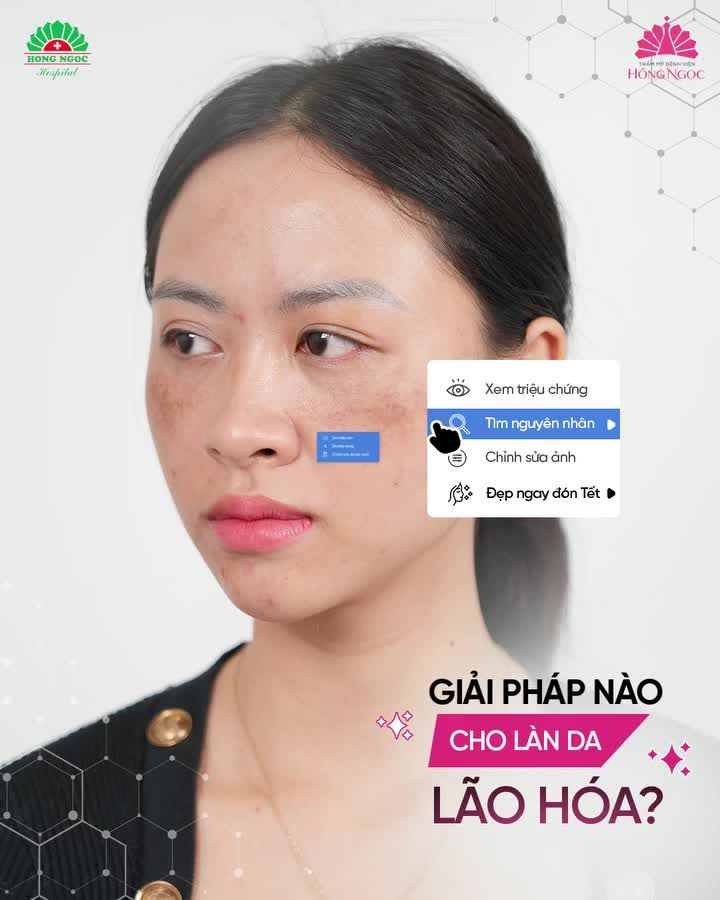 TÂN TRANG DIỆN MẠO - THAY SẮC ĐỔI VẬN - CẢ NĂM HANH THÔNG VỚI MESO PERFECT FACE
