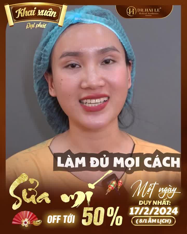 Xóa bỏ nếp mí lỗi hỏng - Rinh ngàn ưu đãi khủng ngày khai xuân