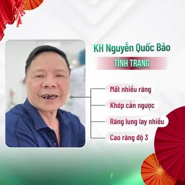 KHÁCH HÀNG TRUNG NIÊN LẤY LẠI KHẢ NĂNG ĂN NHAI VÀ TÍNH THẨM MỸ CHO NỤ CƯỜI