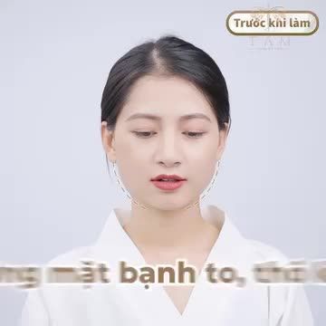 THON GỌN HÀM - CẢI THIỆN MẶT VUÔNG, THÔ BẠNH VỚI ƯU ĐÃI LÊN ĐẾN 30%