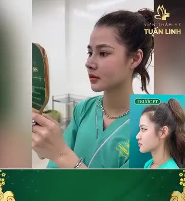 Tham khảo dáng mũi siêu xinh và siêu sang tại Tuấn Linh!!