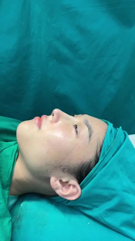 Hai ca nâng mũi cấu trúc  đầu năm vừa hoàn thành