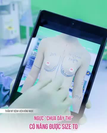 NGỰC CHƯA "DẬY THÌ" CÓ NÂNG ĐƯỢC SIZE TO?