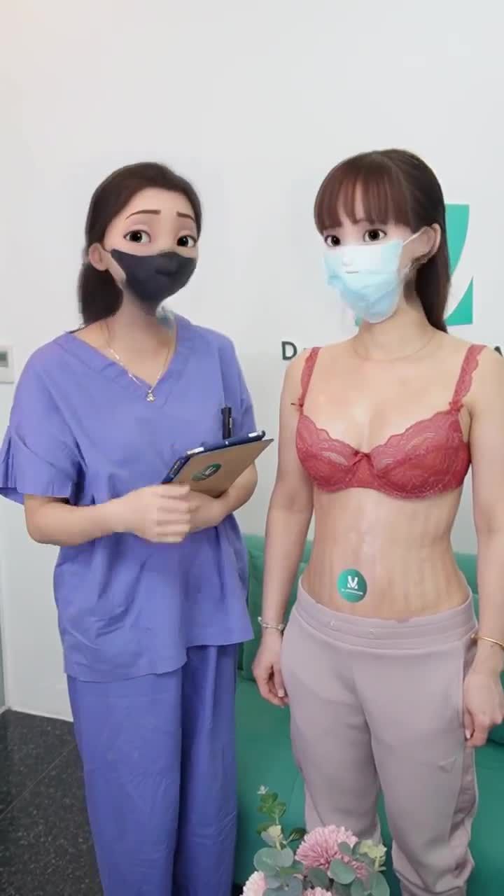 Chị khách hàng Việt kiều quyết định đến với Dr. Minh Phạm để tân trang body toàn diện. Cùng theo dõi livestream để thấy được sự thay đổi của chị khách hàng nhé!