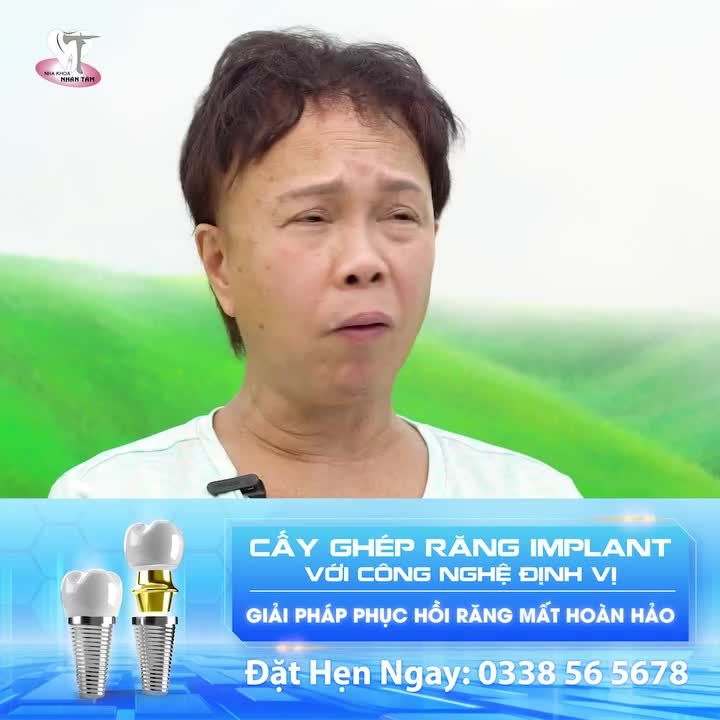 “Tái sinh nụ cười” cùng giải pháp cấy ghép răng Implant