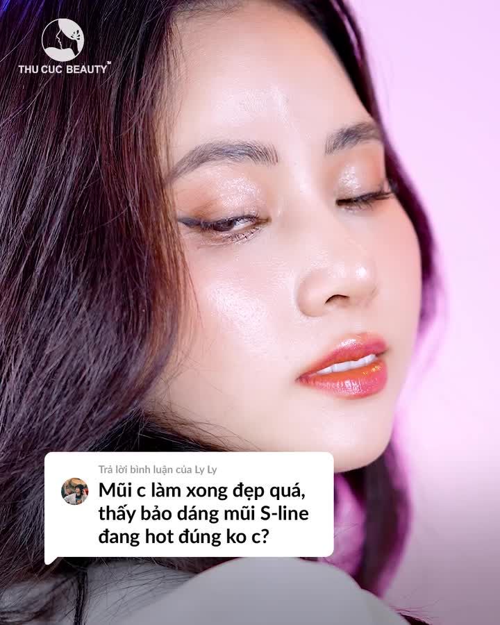 Khách hàng làm mũi S- Line đẹp chuẩn tỷ lệ vàng