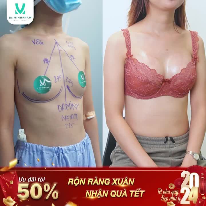 Một chiếc VÒNG 1 NHƯ MƠ - CHẠM LÀ NHUNG NHỚ.