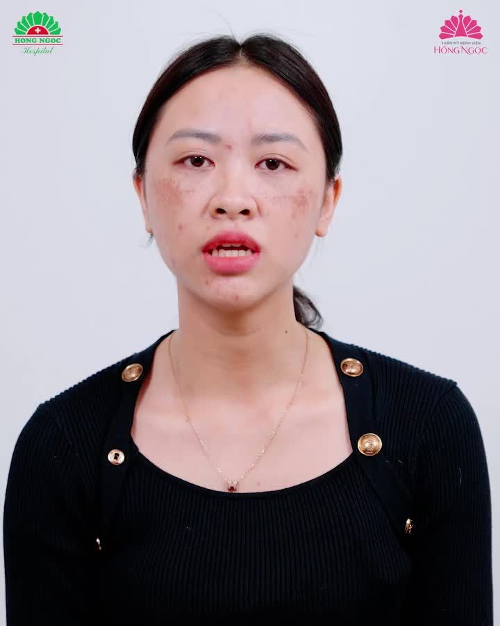 Mẹ bỉm sau sinh tự tin với diện mạo mới sau khi thực hiện Meso Perfect Face
