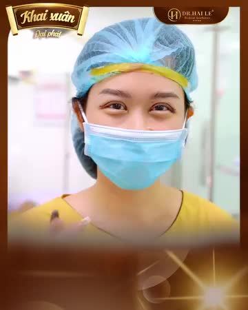 Nhớ lại mùa Xuân ngày đó, một mùa Xuân rạng rỡ khi nếp mí chưa bị lỗi hỏng, giờ phải làm sao để tự tin như trước?