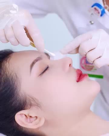 Khai sắc rinh vàng cùng nâng mũi TC