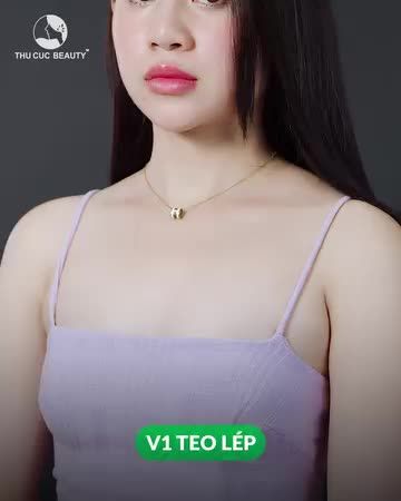 Khách hàng hài lòng với nâng ngực Thu Cúc