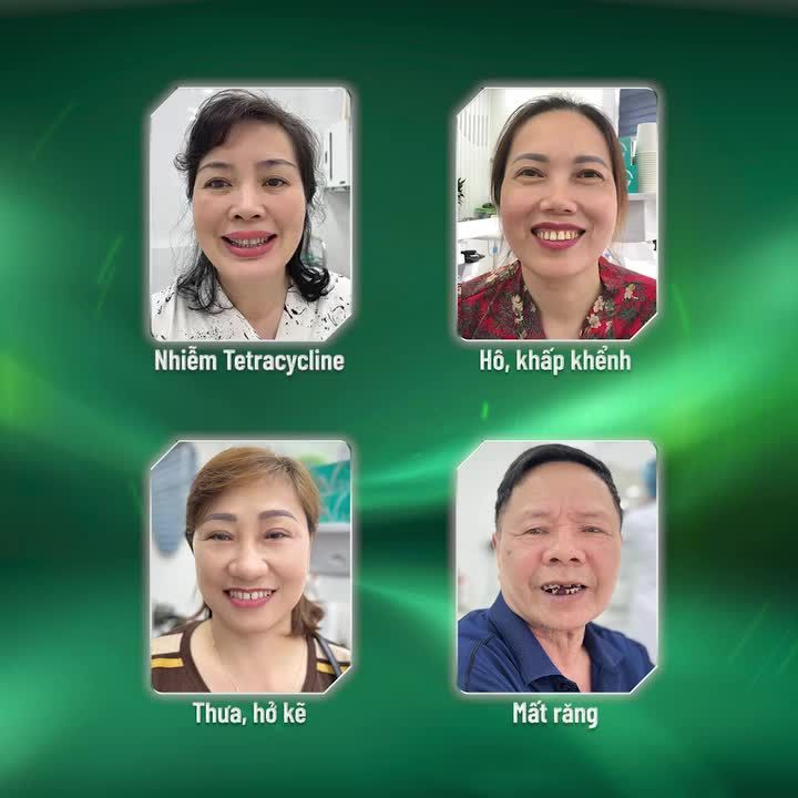 CÁC ANH CHỊ RĂNG XẤU HÃY ĐẾN NHA KHOA GIA ĐÌNH NGAY THÔI!