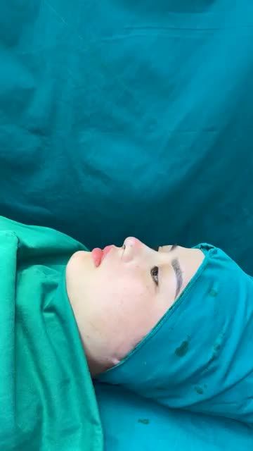 Case mũi cấu trúc vừa hoàn thành