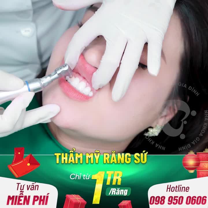 CHỈ 30 SUẤT TRONG THÁNG 2 NÀY. ƯU ĐÃI LÊN TỚI 70% CHỈ TỪ 1TR/RĂNG