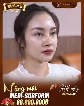 Thay dáng mũi, đổi thời vận, gương mặt thanh tú nhờ nâng mũi tại Dr.Hải Lê - Bao nhiêu ưu đãi nâng mũi HOT hội tụ trong ngày Khai Xuân: