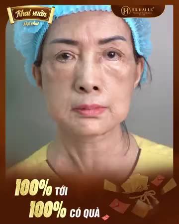 Biết tin gì chưa, mí hỏng không còn là điều khiến bạn phải lo lắng thêm nữa!
