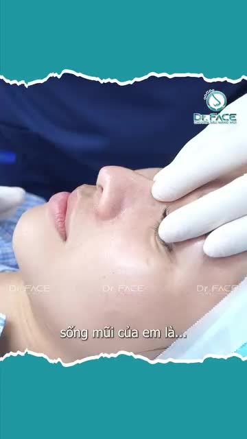 NÂNG MŨI XONG TỰ NHIÊN BỊ GỒ LÀ SAO TA?