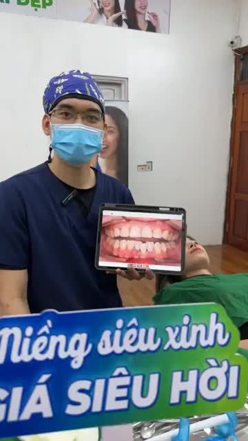 Cận cảnh ca gắn mắc cài bắt đầu quá trình chỉnh nha khắc phục tình trạng răng lệch lạc cho bạn Quỳnh tại Nha khoa Thuỳ Anh.