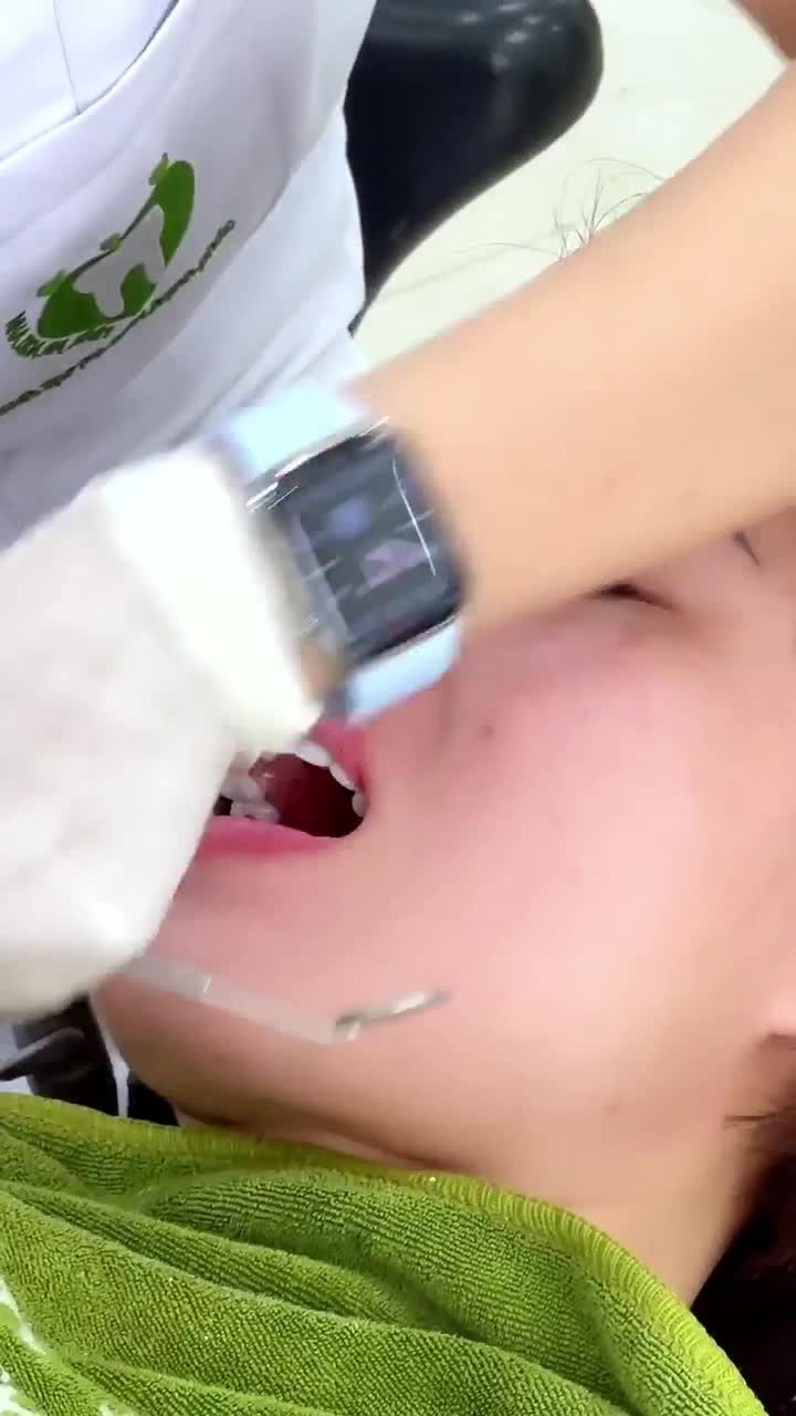 CHỈNH LẠI KHỚP CẮN VÀ VỆ SINH RĂNG MIỆNG CHO KHÁCH HÀNG SAU KHI THẨM MỸ RĂNG SỨ