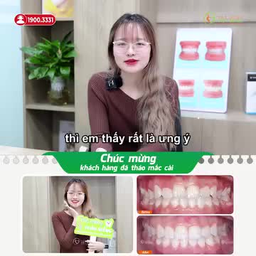 ƯNG Ý VỚI NỤ CƯỜI, SỰ THAY ĐỔI SAU NIỀNG RĂNG KHẤP KHỂNH