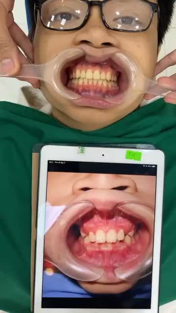 Khách hàng niềng răng