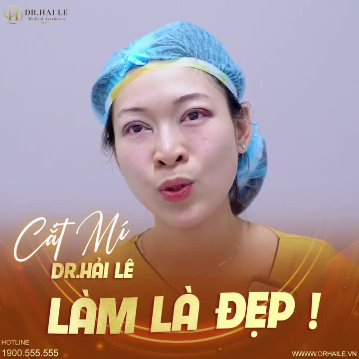 Cắt mí Dr Hải Lê nhìn là đẹp