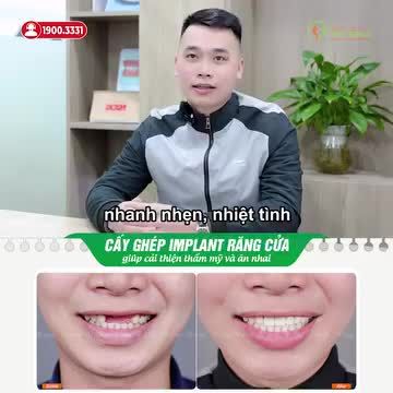LÀM HÀM GIẢ THÁO LẮP HAY C.ẤY IMPLANT RĂNG CỬA