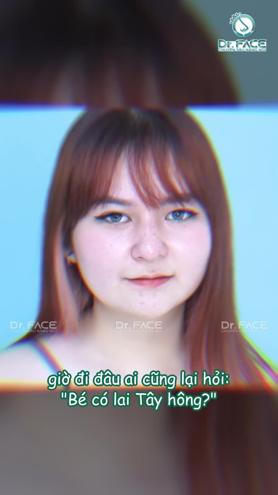 Nâng mũi xong NHIỀU ANH XIN “IN TƯ” là sao?