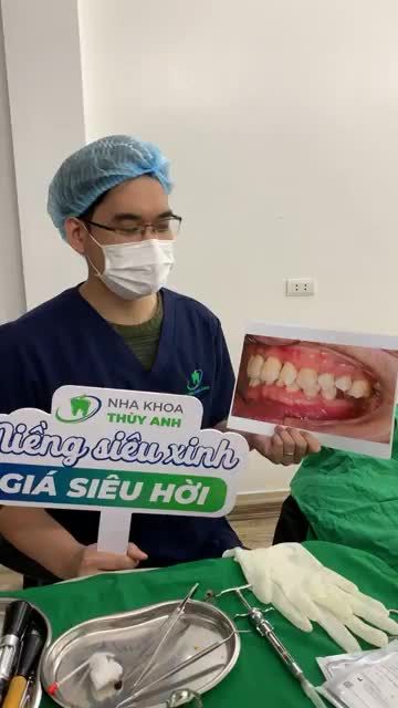 Ca cấy minivits đánh lún răng tại vị trí trồng implant.