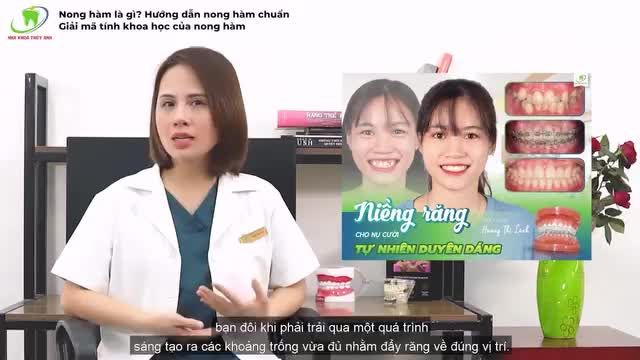 GIẢI ĐÁP TẤT CẢ VẤN ĐỀ VỀ NONG HÀM KHI NIỀNG RĂNG