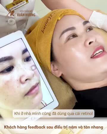 Tự ý chữa nám là nguyên nhân khiến rất nhiều chị em bị lên nám nặng hơn, đậm hơn và khó chữa hơn