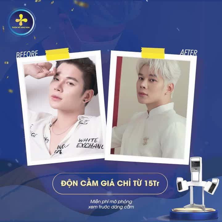 CẰM FILLER KHÔNG ƯNG Ý XỬ LÝ NHƯ THẾ NÀO?