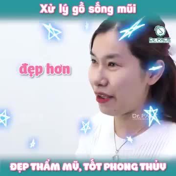 XỬ LÝ GỒ SỐNG MŨI đẹp thẩm mỹ, tốt phong thủy