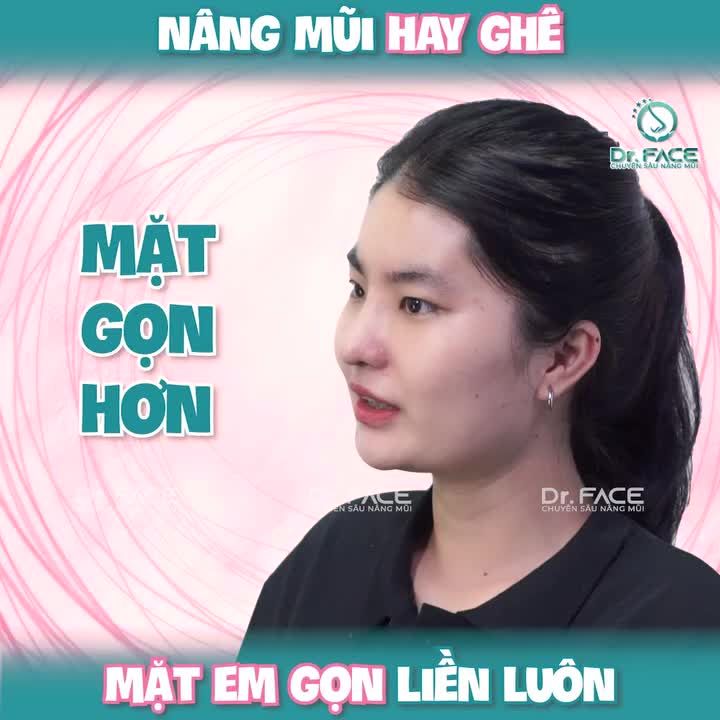 “Nâng Mũi Hay Ghê, Mặt Em Gọn Liền Luôn”