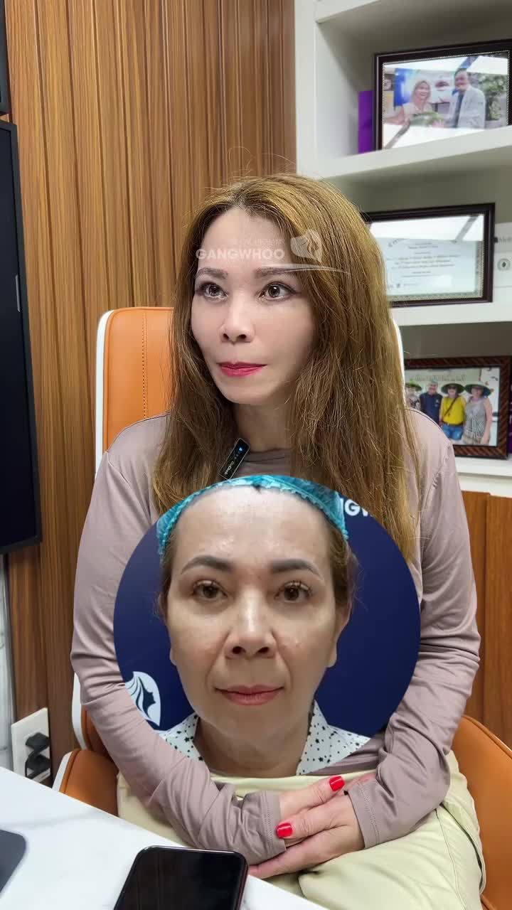 Nhan sắc 61 tuổi vạn người mê nhờ căng da mặt SMAS tại Bệnh viện Gangwhoo
