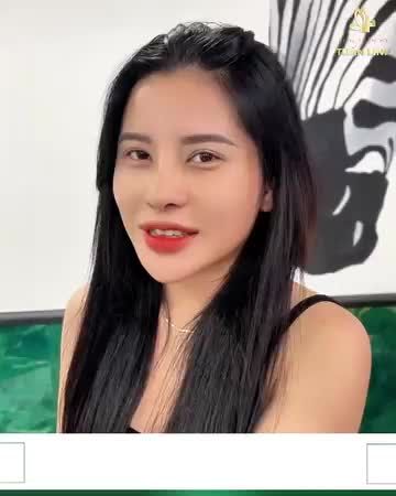 Nâng mũi cấu trúc - Kiến tạo góc nghiêng ''thần thánh" chỉ sau 10 ngày!!