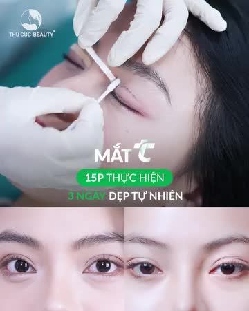 15 phút xóa sổ mắt một mí
