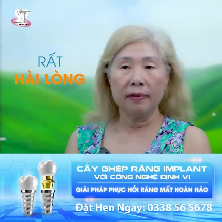 Cấy ghép Implant - Nụ cười tỏa sáng, sức khỏe trọn vẹn