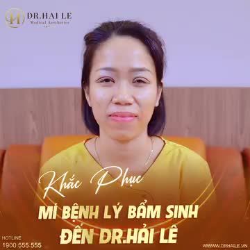 Khắc phục mí bệnh lí mắt bẩm sinh