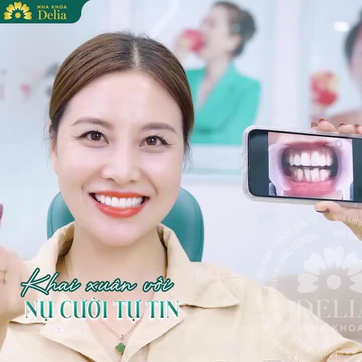 TIẾT LỘ 3 LÝ DO NÊN LÀM RĂNG SỨ DỊP ĐẦU NĂM MỚI TẠI DELIA