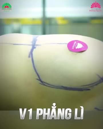 V1 Siêu đẹp - Siêu tự nhiên chỉ sau 60p nâng cấp Căng tròn - Sexy quyến rũ - Đẹp mọi góc nhìn