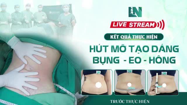 Sau khi đo vẽ thì sau hơn 60 phút, ekips Bác sĩ Lương Ngọc đã giải quyết hết mỡ thừa vùng bụng cho chị T.
