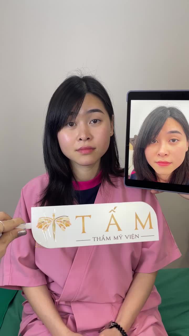 TỪ NƯỚC NGOÀI VỀ CHỈ ĐỂ LÀM FILLER CẰM TẠI TMV TẤM