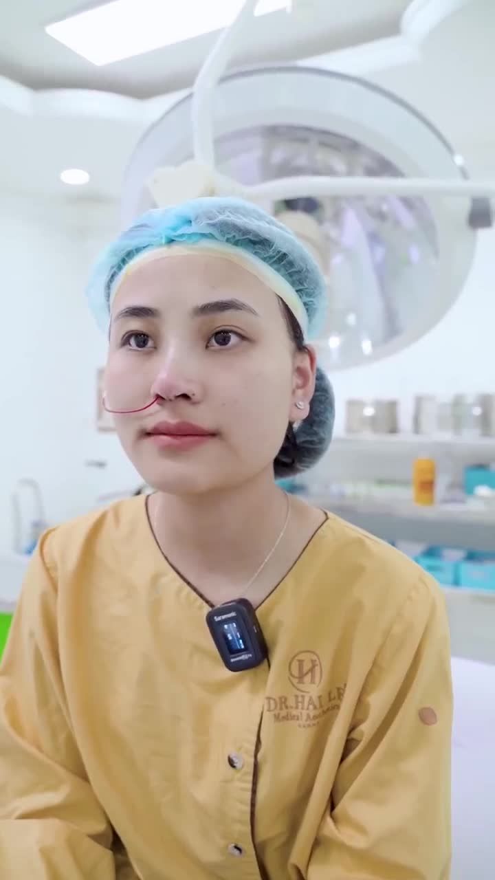 Thành quả dáng mũi siêu xinh sau 60 phút Nâng mũi tại Dr.Hải Lê!