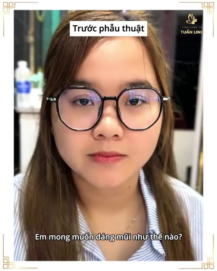 Bác sĩ hỏi " Em mong muốn dáng mũi như thế nào?" Khách nói '' Miễn đẹp là được bác ơi. Em giao hết cho bác đó".