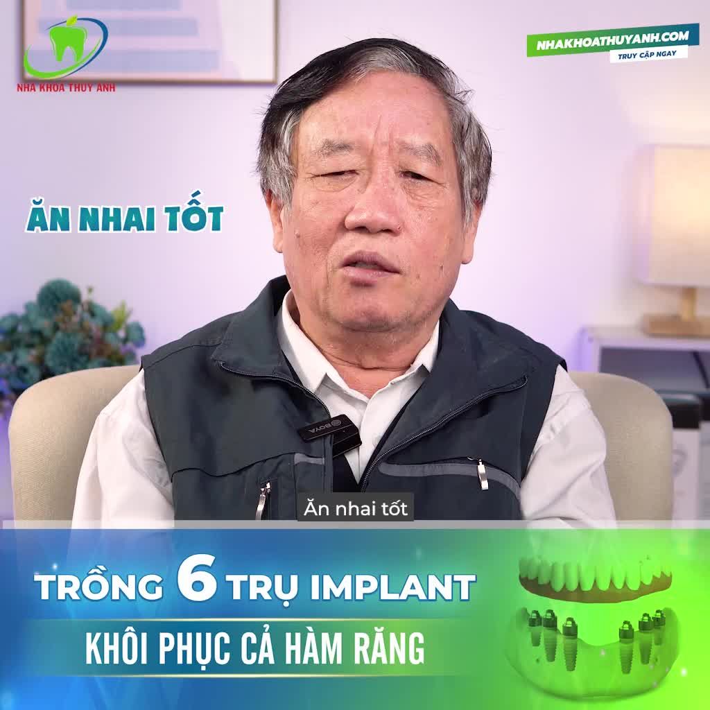 BÁC QUẢNG HÀI LÒNG TUYỆT ĐỐI SAU KHI TRỒNG RĂNG IMPLANT TOÀN HÀM TẠI THÙY ANH