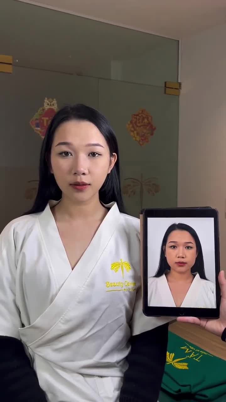 HÀNH TRÌNH THON GỌN HÀM THÀNH CÔNG CỦA CHỊ KHÁCH TẠI THẨM MỸ VIỆN TẤM